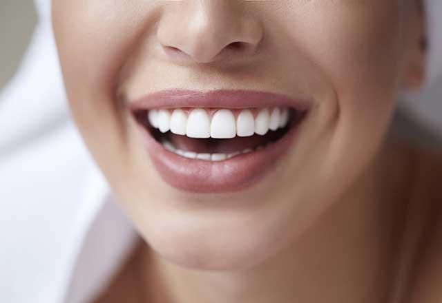 smile showing woman's teeth